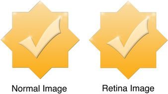 normal and retina image