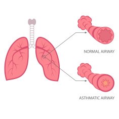 Asthma free image download