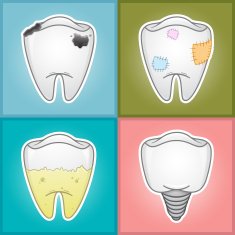Teeth - Illustration