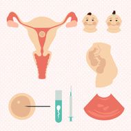 IVF (in vitro fertilisation) Twins