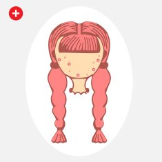 Teenage girl with a pimple and Acne