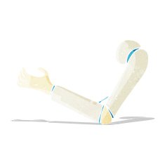 cartoon prosthetic arm N3