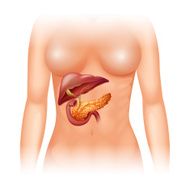 Pancreas cancer human
