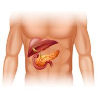 Pancreas cancer diagram in detail N3