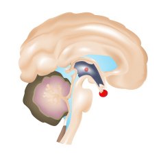 Human Brain N18