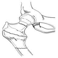 Bone N2