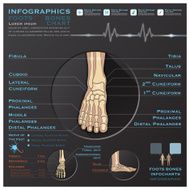 Foot Bone Skelatal System Infographic Infocharts Health And Medical