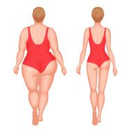 Thick woman and slender