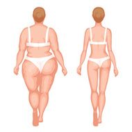 Thick woman and slender N2