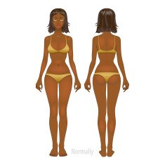Fat and thin woman vector illustration normal anorexia body N2