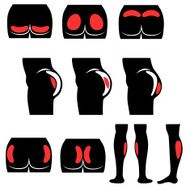 Location buttocks and calf implants