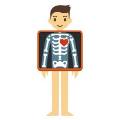 X-ray with cartoon heart N2