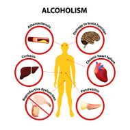 Alcoholism infographic