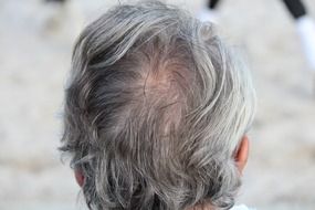 gray hair on a man's head