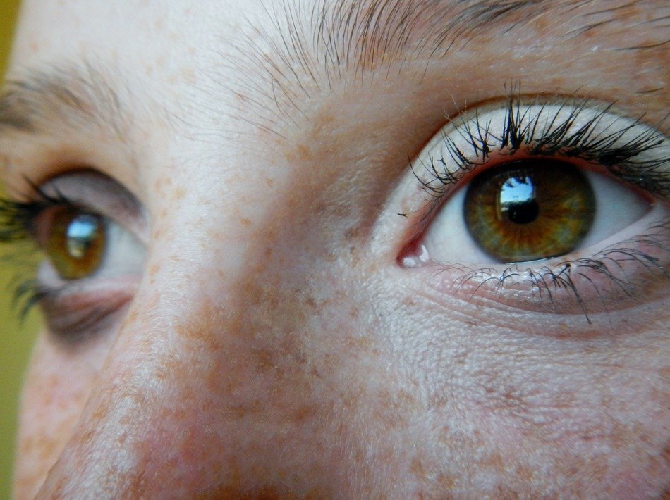 eyes of a girl with freckles