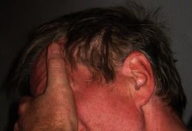 man holds his head