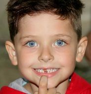 Face of a child with blue eyes and without a tooth