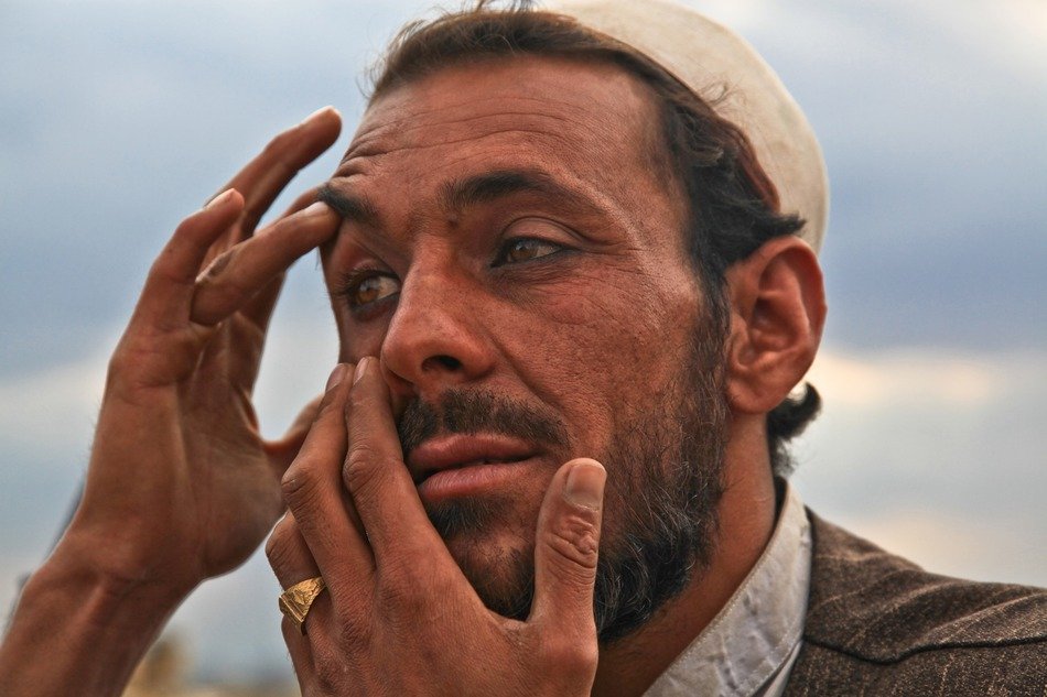 afghan man with eye problem