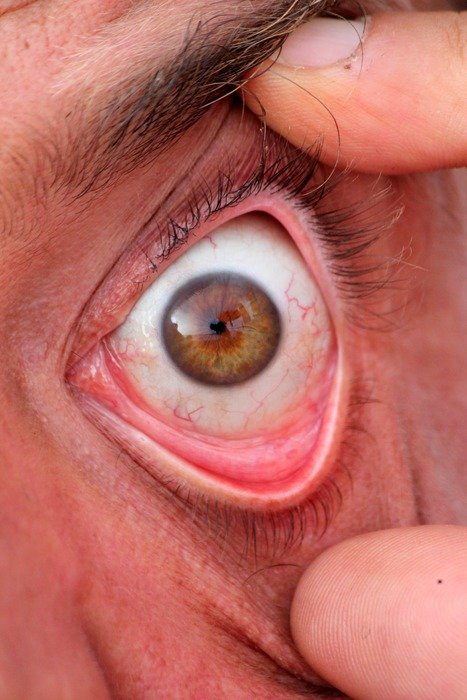 eye with capillaries close up