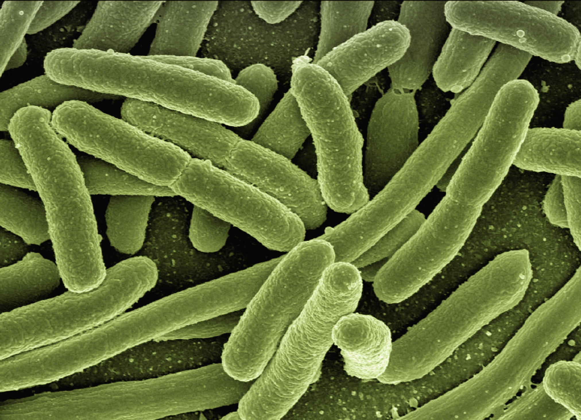 tuberculosis and its pathogenic processes essay tuberculosis and its pathogenic processes essay