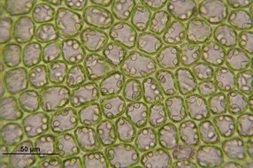 clipart of barbilophozia floerkei cells