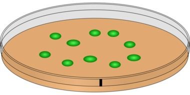 petri dish for culture of bacteria