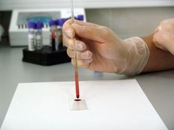 blood sample in the laboratory