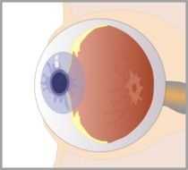 painted eyeball with a pupil