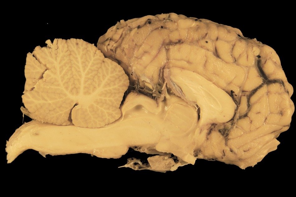 brain of the Horse on a black background