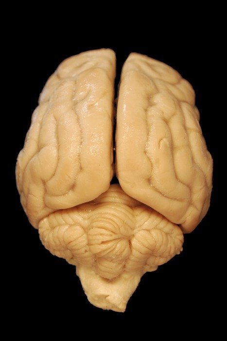 brain anatomy on the black background