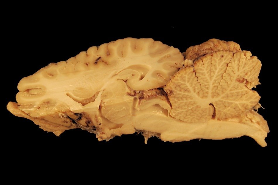The brain of a horse on a black background
