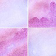 Set of blue pink purple watercolor backgrounds