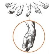 Fig1 &ndash; Rotazione Dell&rsquo;avambraccio Sinistro All&rsquo;impatto
