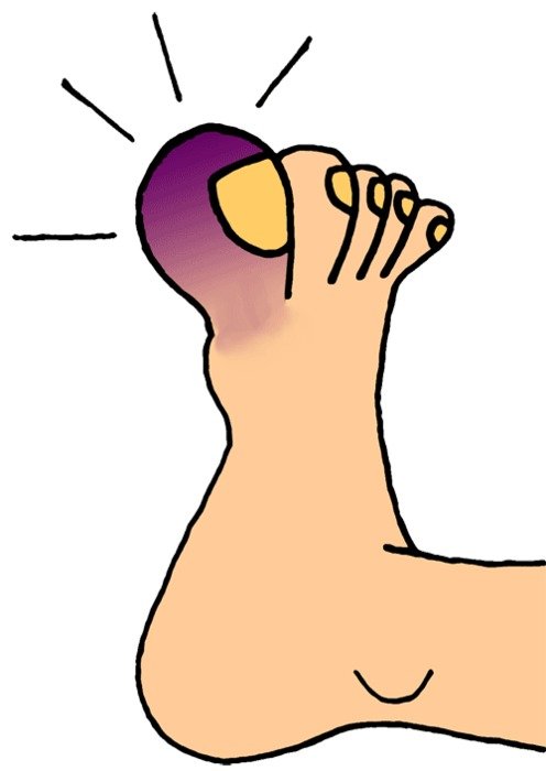 blue toe