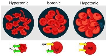 Hypertonic,Isotonic and Hypotonic clipart