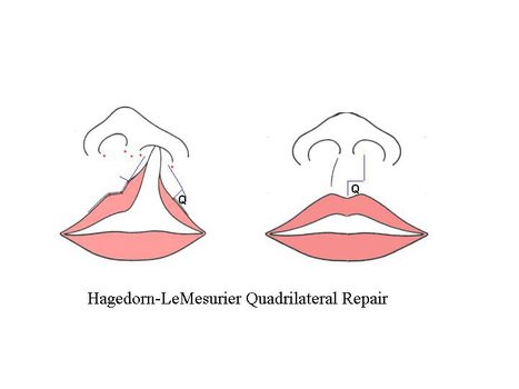 Clip Art Quadrilateral Shape Poem