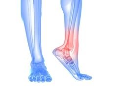 drawing of a damaged leg