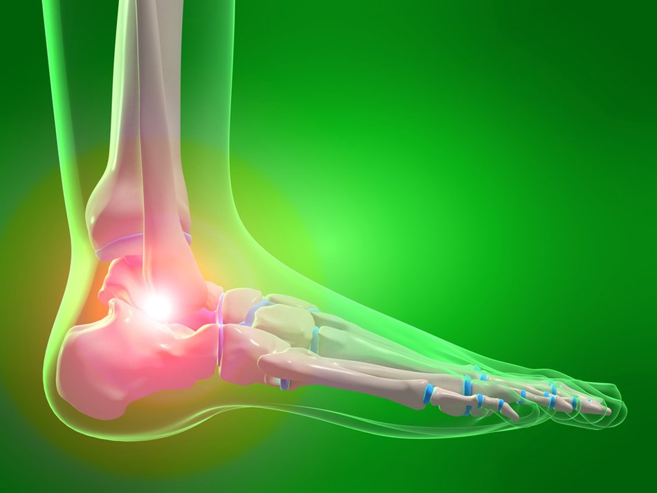 drawing of Pain in Foot Ankle