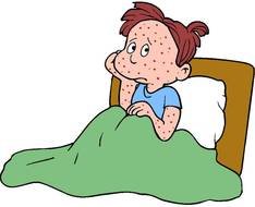 drawing of a child with measles disease