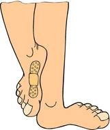 patch on leg drawing