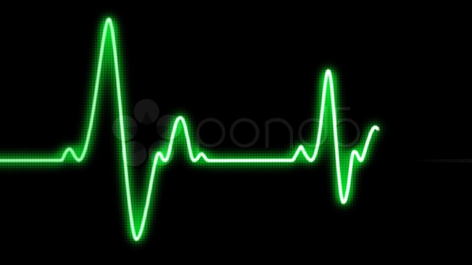 green diagram on the black background