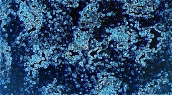 Abstract Textures Background