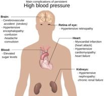 complications of high blood pressure