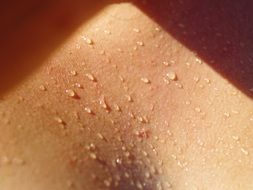 Dewdrops on a body