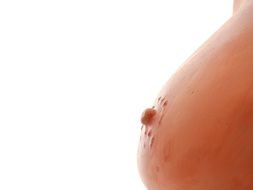 gypsum woman breast