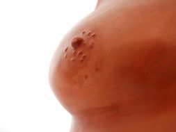 plaster female breast close-up