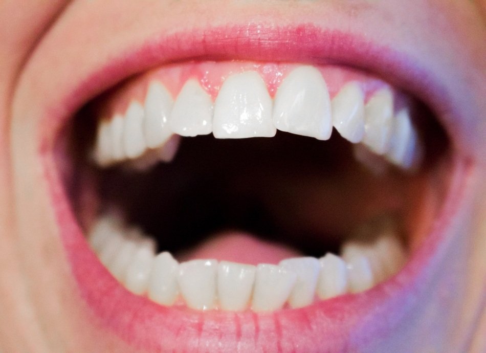healthy teeth