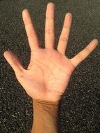 human hand with bulging fingers