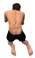 man with scars on his back