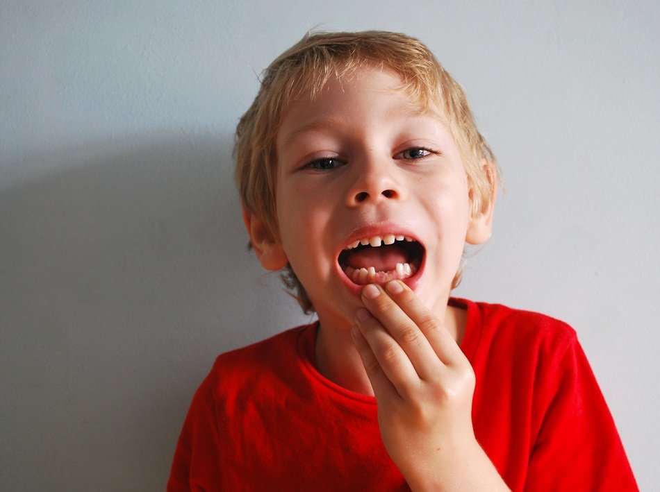 the boy lost milk teeth